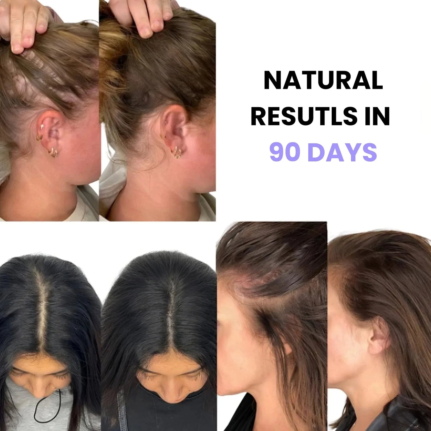 ⏳Begrenzte Zeit 50% Rabatt💥Virale LED-Lichttherapie-Haarbürste