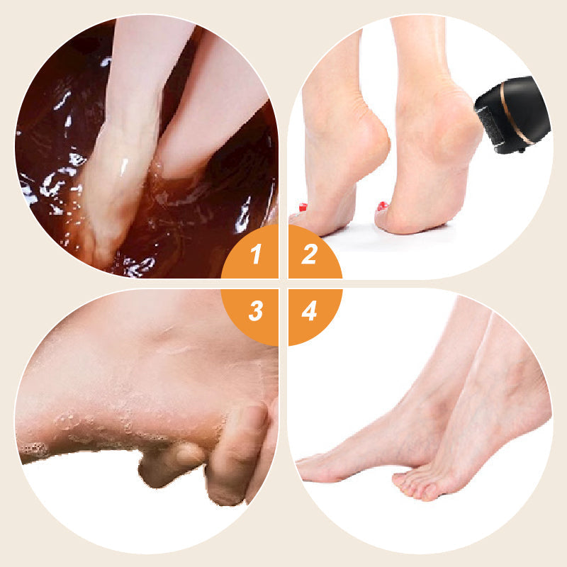 USB-Professioneller elektrischer Fußschleifer für abgestorbene Haut Akkubetriebenes dickeres Leder Polieren Fußpflegewerkzeug