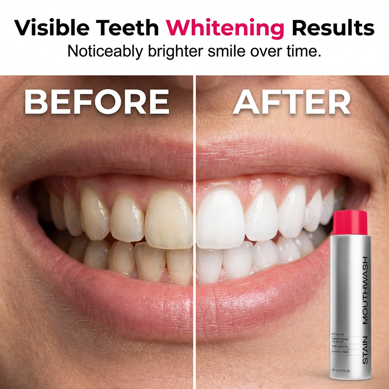 🦷✨ 50% RABATT! Professionelle Mundspülung zur Fleckenentfernung & Zahnaufhellung – Für ein strahlend weißes Lächeln in 1 Woche 💎